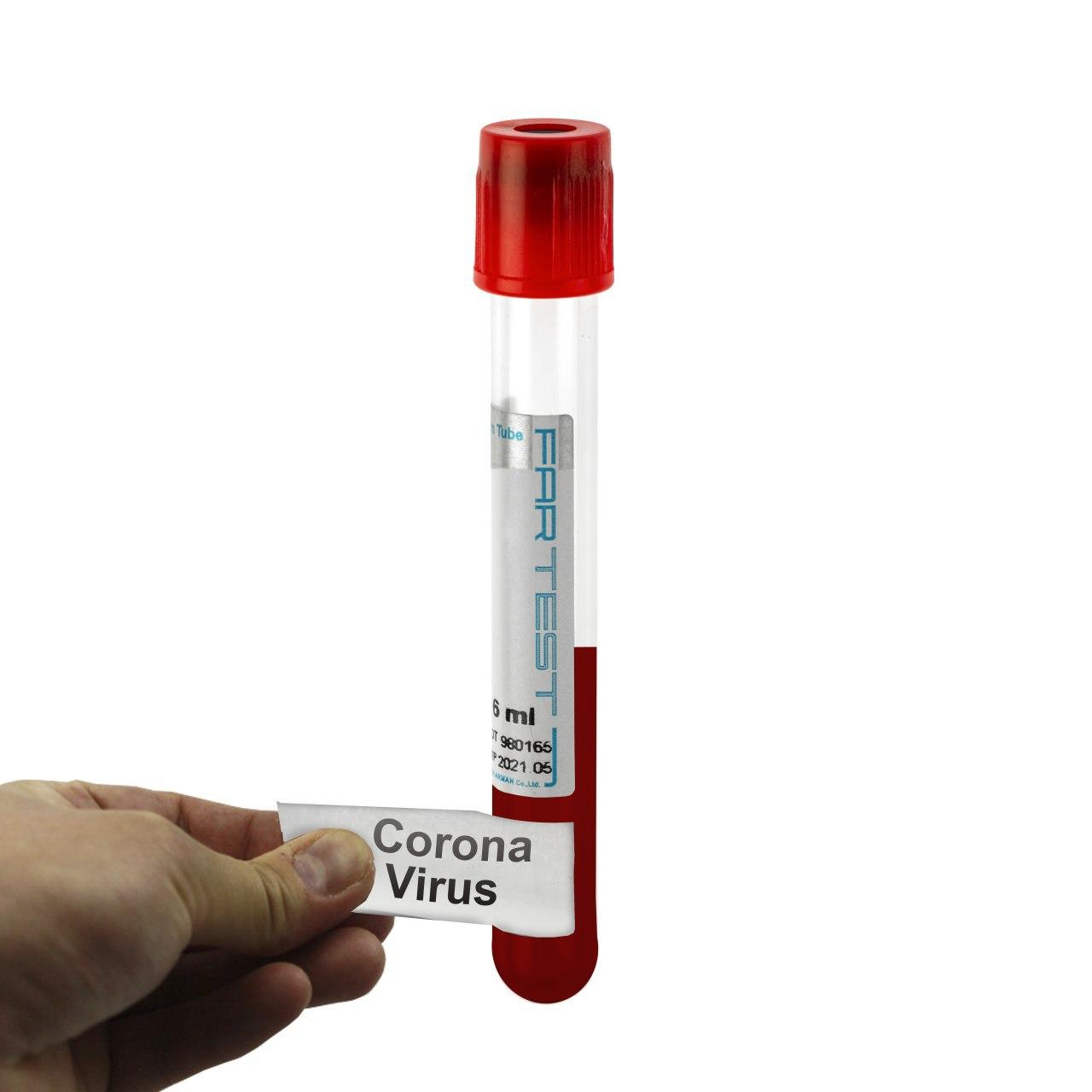 دستورالعمل عمومی پیشگیری از کرونا ویروس